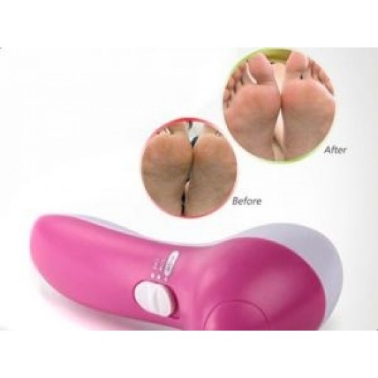 Youssa 7 In 1 Callous Remover & Massager