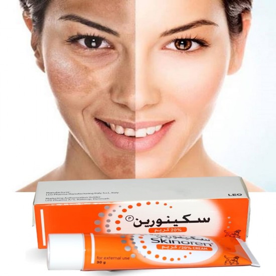 Skinoren cream for whitening, melasma and acne treatment 30 gm